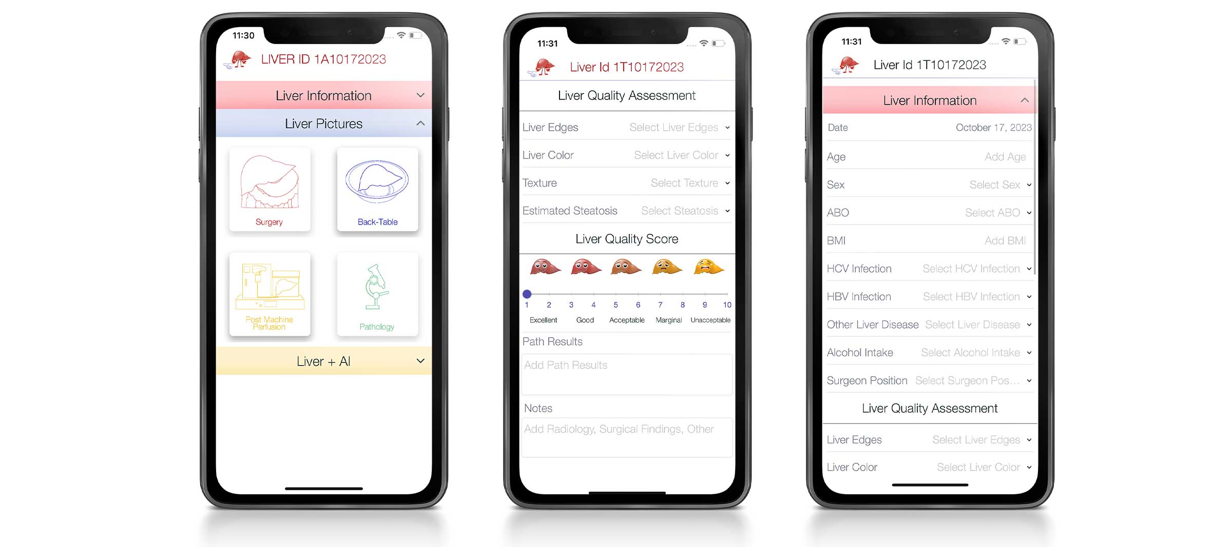 web-gfx-portfolio-2400x-liver-ai-01 web gfx portfolio 2400x liver ai 01
